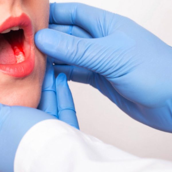 Parodontologia | Trattamenti dello Studio dentistico Foli | Dentista a Genova