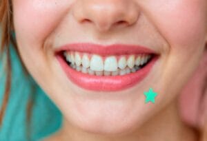 rimozione delle faccette dentali